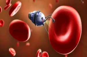 دون الحاجة لجراحة.. رقاقات إلكترونية “تسافر” في الأوعية الدموية لزرع نفسها في الدماغ